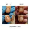 Олія проти оніхолізису NAILS OF THE DAY OniStop, 15 мл