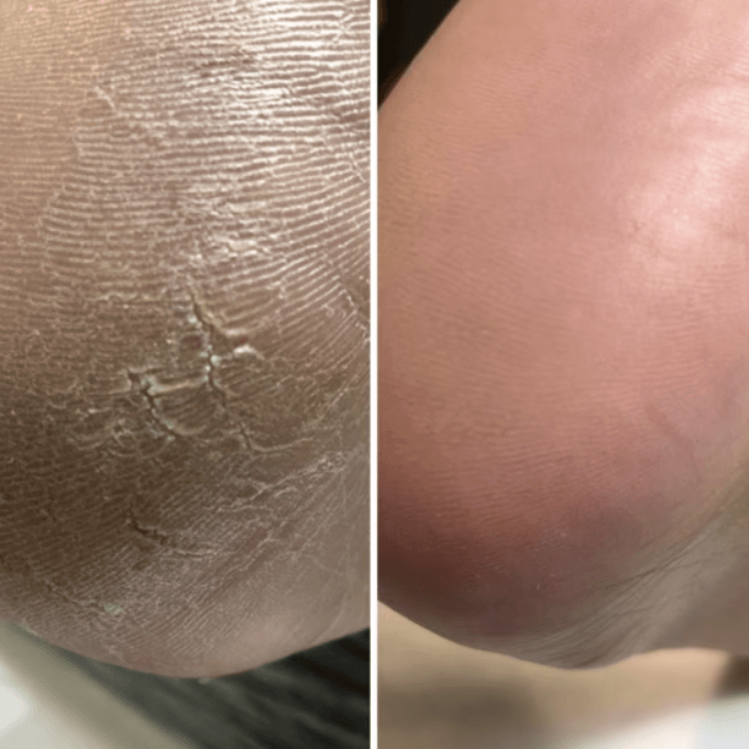 Крем від тріщин для рук та стоб з жожоба Resultum Anti Crack Cream