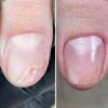 Регенеруючий лосьйон для нігтів Resultum Onistopix Lotion, 10 мл