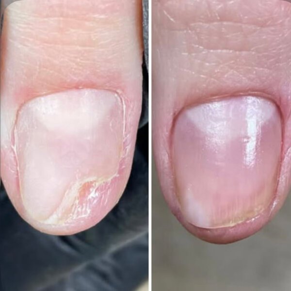 Регенеруючий лосьйон для нігтів Resultum Onistopix Lotion, 10 мл