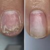 Регенеруючий лосьйон для нігтів Resultum Onistopix Lotion, 10 мл