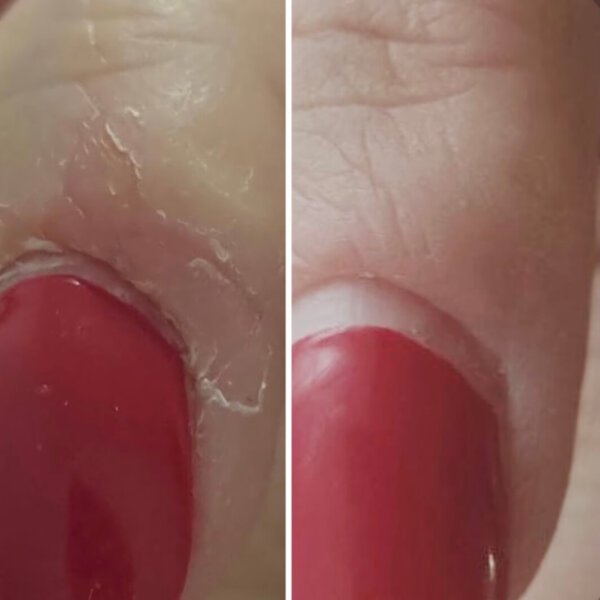 Регенеруючий лосьйон для нігтів Resultum Onistopix Lotion, 10 мл
