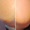 Screenshot Регенеруючий крем від тріщин з обліпихою та лемонграсом Resultum Regenerix Cream, 50 мл
