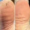 Screenshot Регенеруючий крем від тріщин з обліпихою та лемонграсом Resultum Regenerix Cream, 50 мл