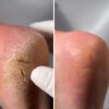 Screenshot Регенеруючий крем від тріщин з обліпихою та лемонграсом Resultum Regenerix Cream, 50 мл