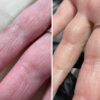 Регенеруюче мило для ніг та рук Resultum Soleverum Soap, 150 мл