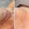 Регенеруюче мило для ніг та рук Resultum Soleverum Soap, 150 мл