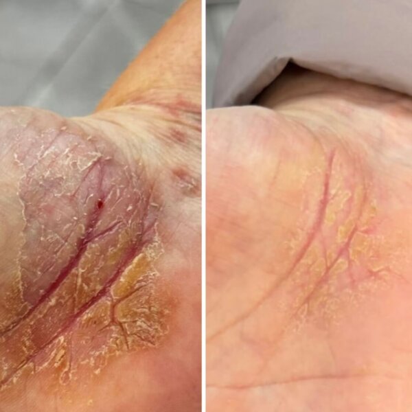 Регенеруюче мило для ніг та рук Resultum Soleverum Soap, 150 мл